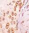 Cell Growth Regulator With EF-Hand Domain 1 antibody, A11706-2, Boster Biological Technology, Immunohistochemistry paraffin image 