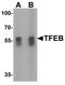 Transcription Factor EB antibody, LS-B8820, Lifespan Biosciences, Western Blot image 