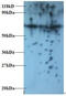 Actin Related Protein 2/3 Complex Subunit 2 antibody, MBS715593, MyBioSource, Western Blot image 