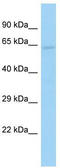 DEP Domain Containing 1B antibody, TA331863, Origene, Western Blot image 