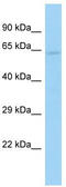 DEP Domain Containing 1B antibody, TA331863, Origene, Western Blot image 