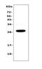 Interleukin 15 Receptor Subunit Alpha antibody, A03016-1, Boster Biological Technology, Western Blot image 