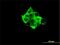 Ribosomal Protein S6 Kinase B1 antibody, H00006198-M03, Novus Biologicals, Immunofluorescence image 