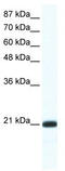 Retina And Anterior Neural Fold Homeobox 2 antibody, TA341421, Origene, Western Blot image 