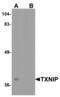 Basic Leucine Zipper ATF-Like Transcription Factor 3 antibody, MBS153454, MyBioSource, Western Blot image 