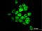 Serine/Threonine Kinase 33 antibody, H00065975-M09, Novus Biologicals, Immunofluorescence image 