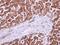 Voltage Dependent Anion Channel 2 antibody, PA5-28106, Invitrogen Antibodies, Immunohistochemistry paraffin image 