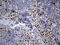 RUNX Family Transcription Factor 3 antibody, M00493, Boster Biological Technology, Immunohistochemistry paraffin image 