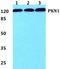 Protein Kinase N1 antibody, A02879, Boster Biological Technology, Western Blot image 