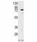 Protein Kinase C Delta antibody, F50028-0.4ML, NSJ Bioreagents, Western Blot image 