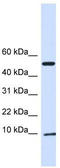 ATP Synthase Inhibitory Factor Subunit 1 antibody, TA346663, Origene, Western Blot image 