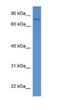 Protein O-Linked Mannose N-Acetylglucosaminyltransferase 1 (Beta 1,2-) antibody, NBP1-74108, Novus Biologicals, Western Blot image 