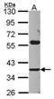 ADP-Ribosyltransferase 3 antibody, PA5-29972, Invitrogen Antibodies, Western Blot image 