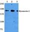 Myomesin 2 antibody, PA5-75419, Invitrogen Antibodies, Western Blot image 