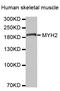Myosin Heavy Chain 2 antibody, MBS129064, MyBioSource, Western Blot image 
