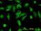 Stress Induced Phosphoprotein 1 antibody, LS-B6208, Lifespan Biosciences, Immunofluorescence image 