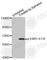 Estrogen Receptor 1 antibody, AP0146, ABclonal Technology, Western Blot image 