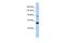 Protein MCM10 homolog antibody, PA5-41323, Invitrogen Antibodies, Western Blot image 