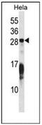 RAP1B, Member Of RAS Oncogene Family antibody, AP53579PU-N, Origene, Western Blot image 