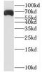 Leucine Zipper Tumor Suppressor 1 antibody, FNab04917, FineTest, Western Blot image 