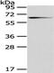 Glutamate Decarboxylase 1 antibody, CSB-PA981570, Cusabio, Western Blot image 