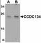 Coiled-Coil Domain Containing 134 antibody, orb89837, Biorbyt, Western Blot image 