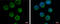 CD20 antibody, GTX100209, GeneTex, Immunocytochemistry image 