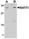 N(Alpha)-Acetyltransferase 40, NatD Catalytic Subunit antibody, orb75334, Biorbyt, Western Blot image 