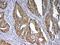 DNA Methyltransferase 1 antibody, A00172-1, Boster Biological Technology, Immunohistochemistry paraffin image 