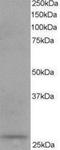 Dicarbonyl And L-Xylulose Reductase antibody, NB100-1068, Novus Biologicals, Western Blot image 