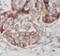 TNF-a antibody, FNab08821, FineTest, Immunohistochemistry paraffin image 