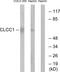 Chloride Channel CLIC Like 1 antibody, PA5-39100, Invitrogen Antibodies, Western Blot image 