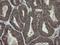 Zinc Finger C2HC-Type Containing 1B antibody, NBP2-45700, Novus Biologicals, Immunohistochemistry frozen image 