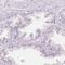 SIGLEC6 antibody, HPA018198, Atlas Antibodies, Immunohistochemistry frozen image 