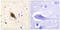 Sodium Channel Epithelial 1 Beta Subunit antibody, LS-C199336, Lifespan Biosciences, Immunohistochemistry frozen image 