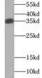 TNF Superfamily Member 11 antibody, FNab09838, FineTest, Western Blot image 