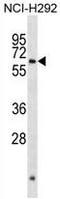 Aristaless Related Homeobox antibody, AP50264PU-N, Origene, Western Blot image 