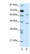 TRNA Methyltransferase 1 Like antibody, NBP1-79968, Novus Biologicals, Western Blot image 