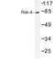 Ribosomal protein S6 kinase alpha-6 antibody, LS-C177029, Lifespan Biosciences, Western Blot image 