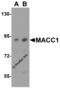 MET Transcriptional Regulator MACC1 antibody, 5197, ProSci, Western Blot image 