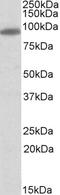 Myosin VIIA And Rab Interacting Protein antibody, LS-B4969, Lifespan Biosciences, Western Blot image 