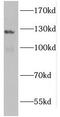 Guanylate Cyclase 2F, Retinal antibody, FNab03729, FineTest, Western Blot image 