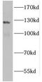 Retinal guanylyl cyclase 2 antibody, FNab03729, FineTest, Western Blot image 