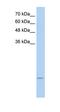 Ubiquitin Conjugating Enzyme E2 I antibody, orb330272, Biorbyt, Western Blot image 