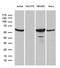 Protein Phosphatase 2 Scaffold Subunit Abeta antibody, LS-C799127, Lifespan Biosciences, Western Blot image 