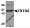 Zinc Finger And BTB Domain Containing 8A antibody, 6129, ProSci, Western Blot image 