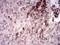 Cytokine Inducible SH2 Containing Protein antibody, orb76299, Biorbyt, Immunohistochemistry paraffin image 