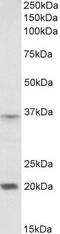 Homeobox A9 antibody, GTX88092, GeneTex, Western Blot image 