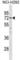 Matrix Metallopeptidase 14 antibody, abx031270, Abbexa, Western Blot image 