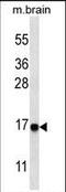 Microtubule Associated Protein 1 Light Chain 3 Alpha antibody, PA5-35196, Invitrogen Antibodies, Western Blot image 